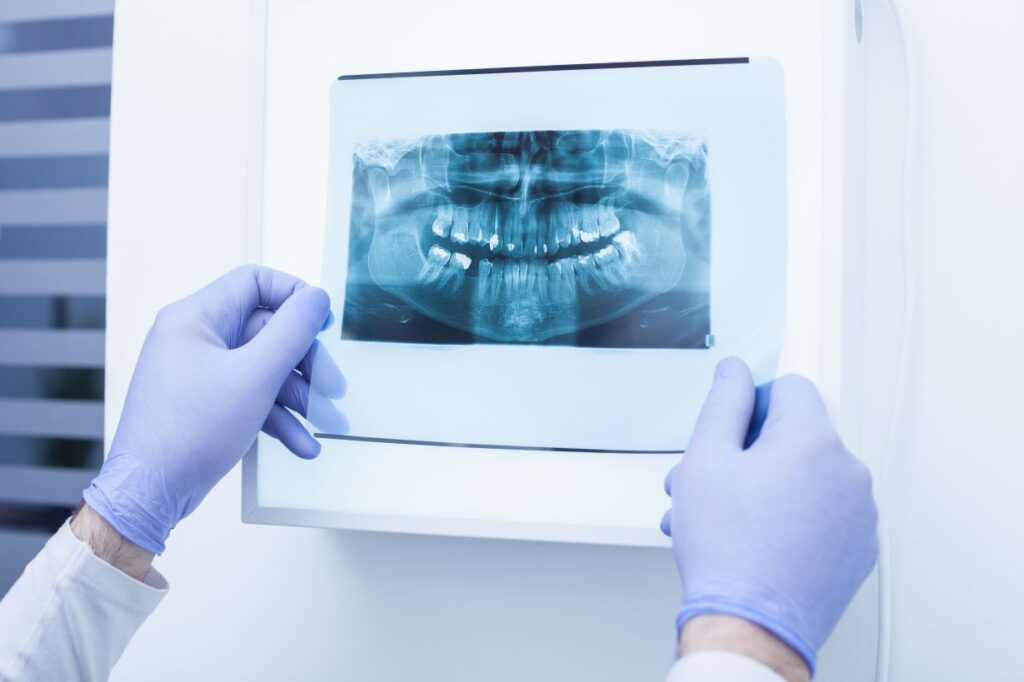 A dentist’s hands holding up a dental x-ray